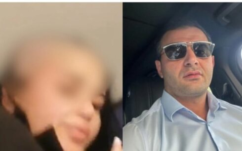 Həyat yoldaşının başını keçəl edən şəxs saxlanıldı