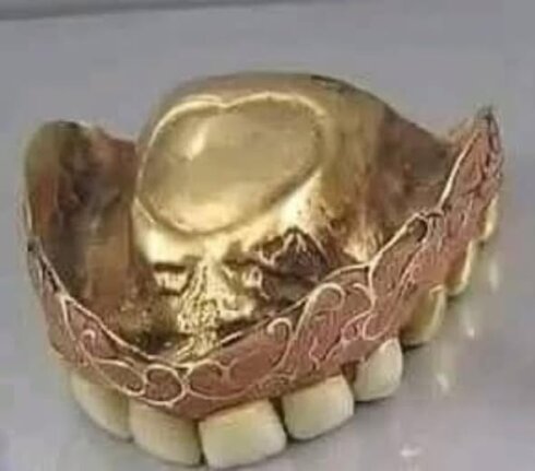 Morris Rabinoviçin beş dəst qızıl protezi