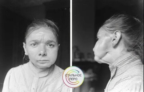 Почему головка спичек красная?