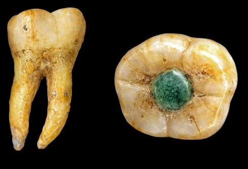 İnsan azı dişinə birbaşa yerləşdirilmiş kiçik, parıldayan yeşim parçası Maya məzarından tapıldı