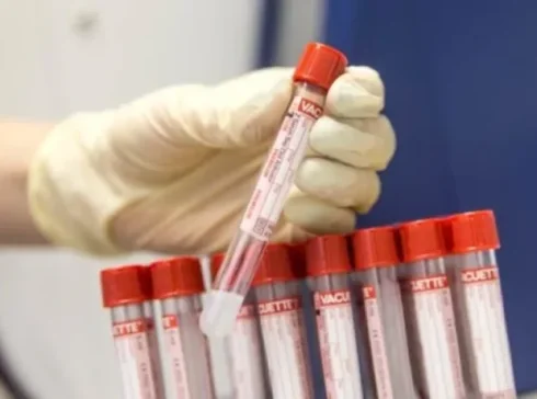 Qan analizindən bu xəstəliyi bilmək olurmuş