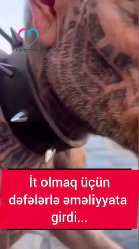 İtə bənzəmək üçün çoxsaylı əməliyyatlar keçirən bir kişi dünya miqyasında xəbər başlıqlarına çıxıb. VİDEO